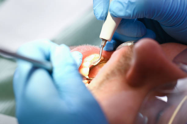 Best Broken or Cracked Tooth Emergency Dentist in Ddanelle, AR